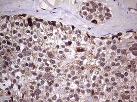 AFAP1 / AFAP Antibody (aa100-386, clone OTI2G9)