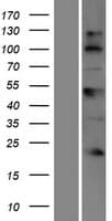 Human BTBD17 Protein (Over-Expression Lysate Myc-DDK (Flag))