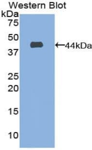 CD63 Antibody (aa103-203)