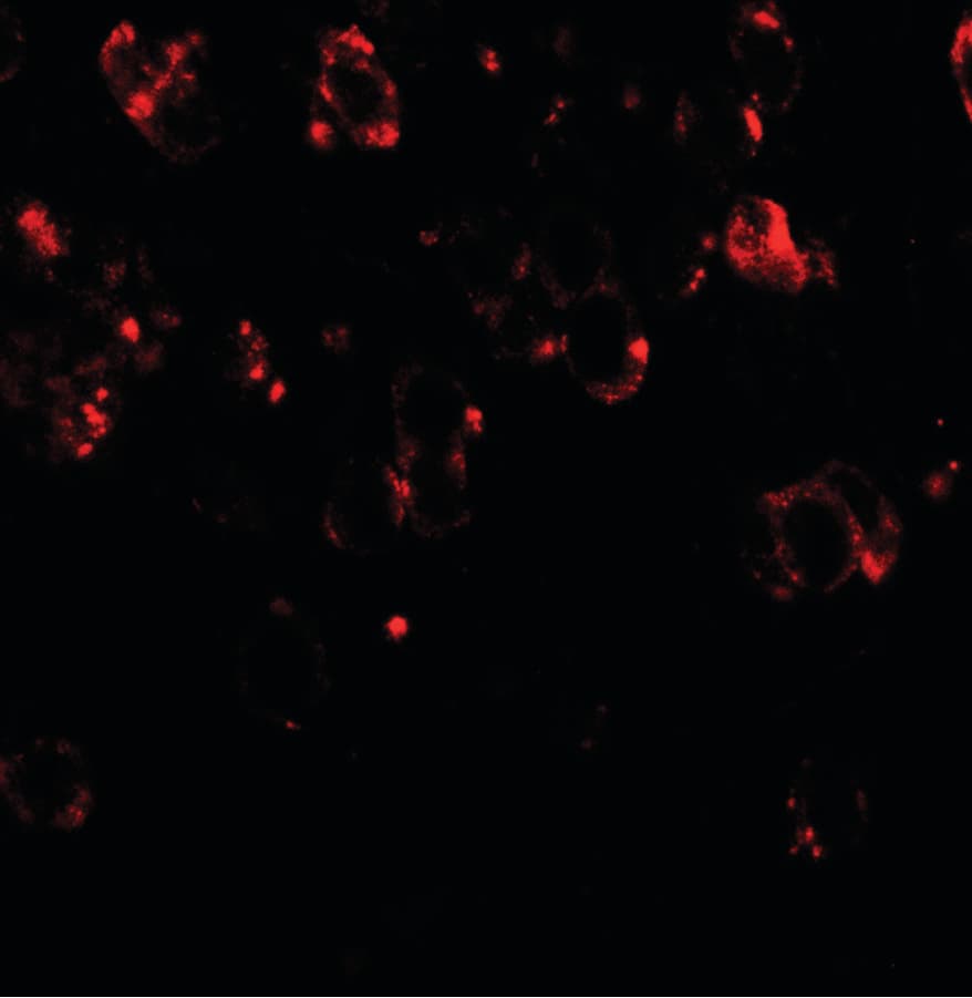 CHD7 Antibody