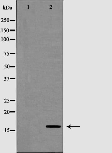 RPB16 / POLR2D Antibody