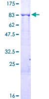 Human KLHL6 Protein (Recombinant GST)