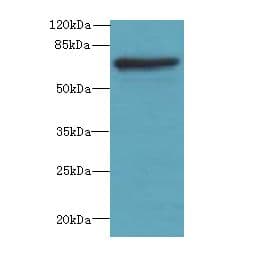 Polyclonal Rabbit anti-Human GBP5 Antibody (IHC, WB)