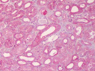 Polyclonal Rabbit anti-Human ABCB1 / MDR1 / P Glycoprotein Antibody (IHC, WB)