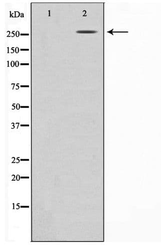 Polyclonal Rabbit anti-Human CREBBP / CREB Binding Protein Antibody (IHC, IF, WB)