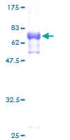 Human TES / Testin Protein (Recombinant GST)