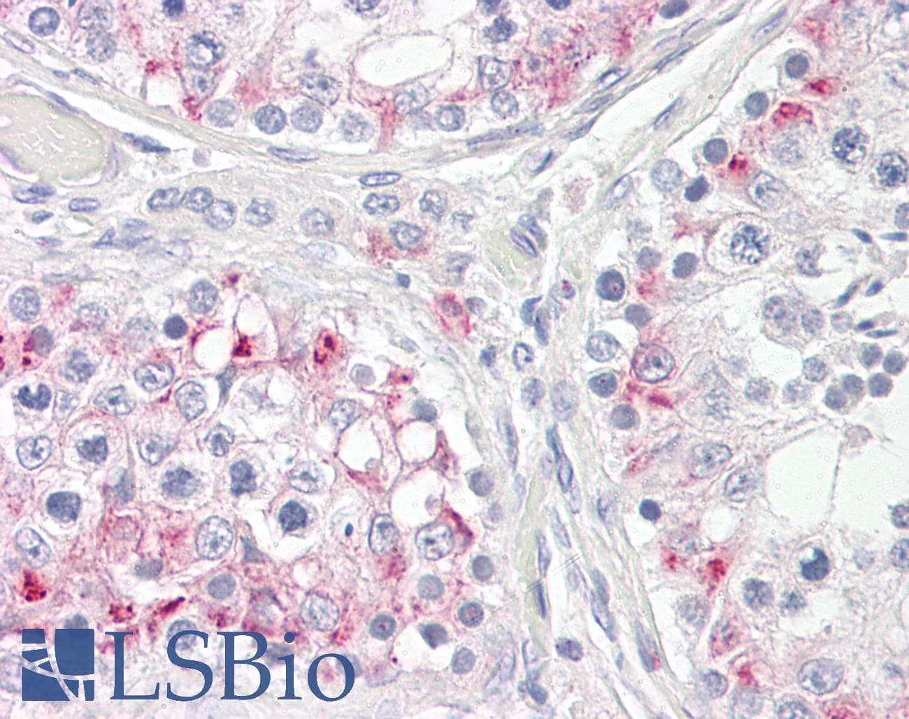 IHC-plus™ CPT1C Antibody (aa737-750)