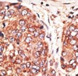 Polyclonal Rabbit anti-Human MAFK Antibody (aa57-85, IHC, WB)
