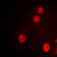 Polyclonal Rabbit anti-Human SPIN / SPIN1 Antibody (Internal, IHC, IF, WB)