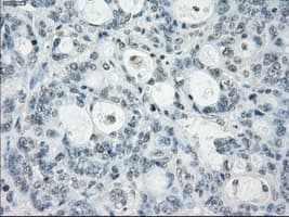 AURKC / Aurora C Antibody (clone OTI2B7)