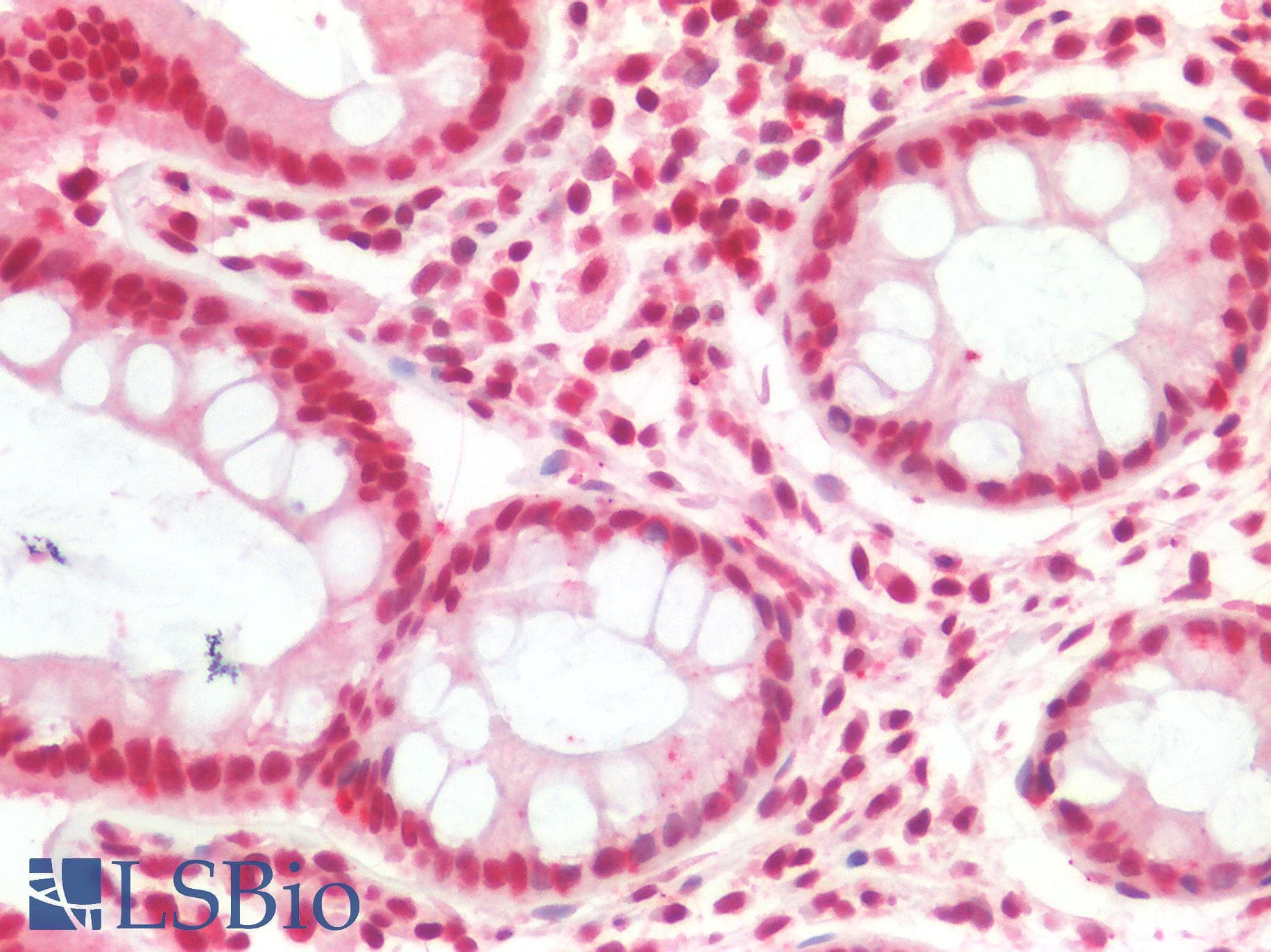 PathPlus™ SMARCB1 / INI1 Antibody