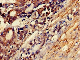 Polyclonal Rabbit anti-Human MYLK Antibody (IHC, IF)