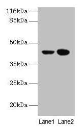 CCR6 Antibody (aa22-374)
