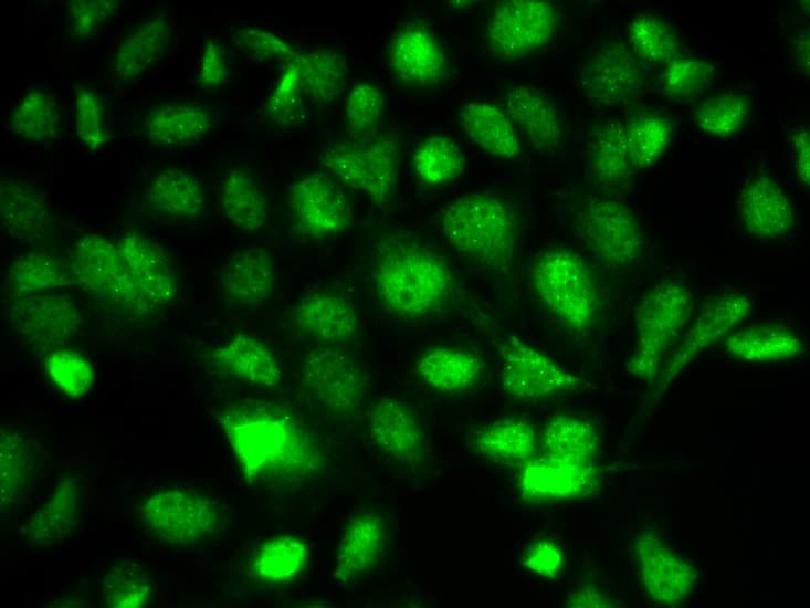 BIRC2 / cIAP1 Antibody