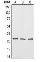 AQP12A / Aquaporin 12A Antibody (C-Terminus)