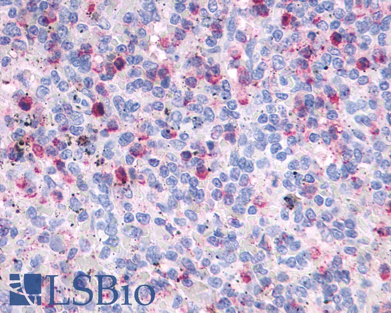 PathPlus™ FPR2 / FPRL1 Antibody (C-Terminus)