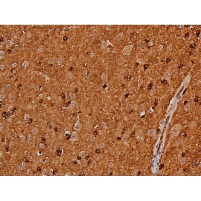 MAPT / Tau Antibody (phospho-Ser262)