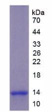 Mouse CGA / hCG Alpha Protein (Recombinant 6His, N-terminus)