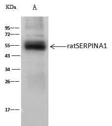 SERPINA1 / Alpha 1 Antitrypsin Antibody (Preservative Free)