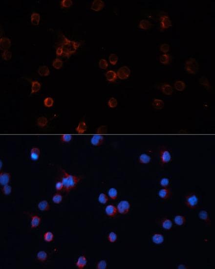 TH / Tyrosine Hydroxylase Antibody