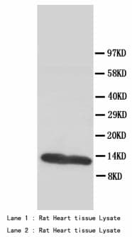 FABP3 / H-FABP Antibody (aa119-133)