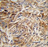 AG3 / AGR3 Antibody (aa119-147)