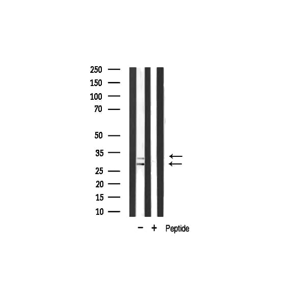COX11 Antibody