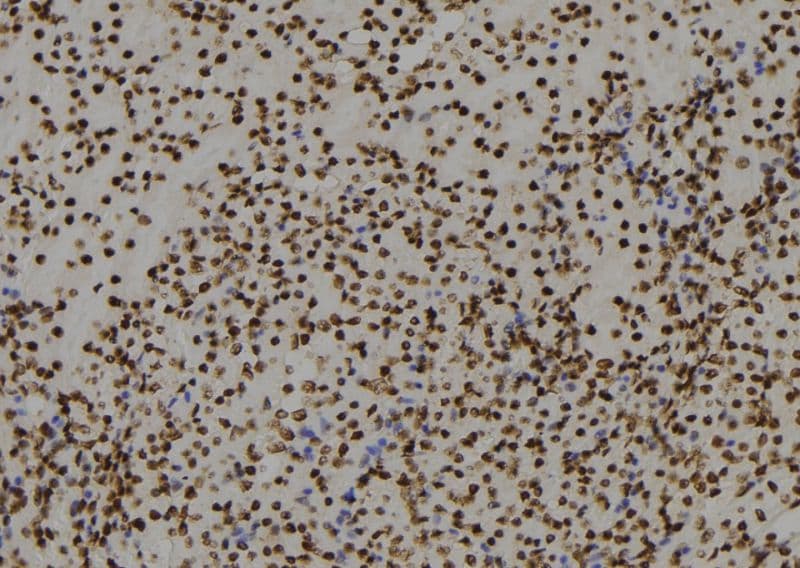 RGS22 Antibody