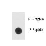 Polyclonal Rabbit anti-Human BAD Antibody (phospho-Ser99, IHC, IF, WB)