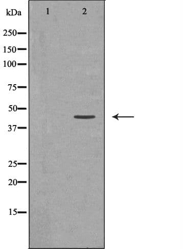 AGER / RAGE Antibody