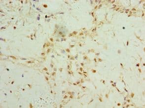 Polyclonal Rabbit anti-Human TET2 Antibody (aa1833-2002, IHC)