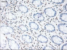 GFAP Antibody (clone OTI4C10)