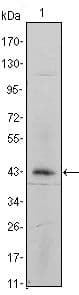 Monoclonal Mouse anti-Human ITGA5/Integrin Alpha 5/CD49e Antibody (clone 10F6, IHC, WB)