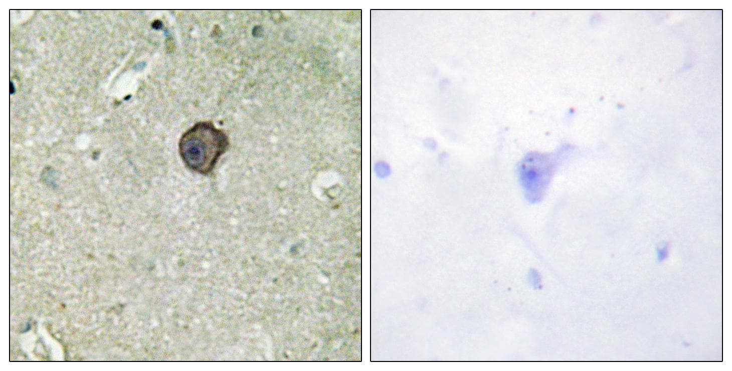 HCK Antibody