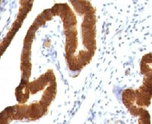 KRT19 / CK19 / Cytokeratin 19 Antibody (clone CTKN19-1, Ready-to-Use)