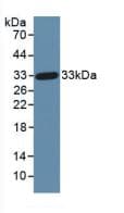 Human DKK1 Protein (Recombinant His, N-Terminal)