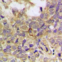 PXN / Paxillin Antibody (N-Terminus)