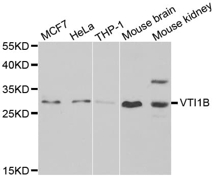 VTI1B Antibody