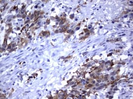 Monoclonal Mouse anti-Human MDM2 Antibody (clone OTI1E6, IHC, WB)