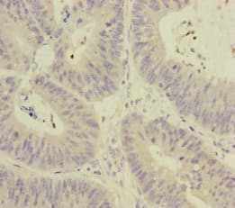 MCCC1 Antibody