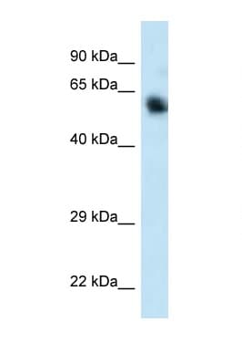 Polyclonal Rabbit anti-Human CAMKK1 Antibody (C-Terminus, WB)