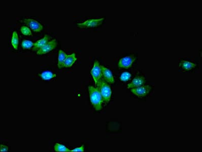 KLHL42 / KLHDC5 Antibody