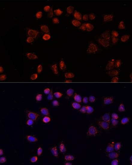 Polyclonal Rabbit anti-Human SLC25A4 / ANT Antibody (IF)