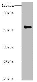 PARP3 Antibody (aa294-533)