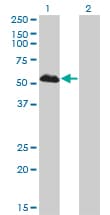 PathPlus™ FOXA1 Antibody (clone 2D7)