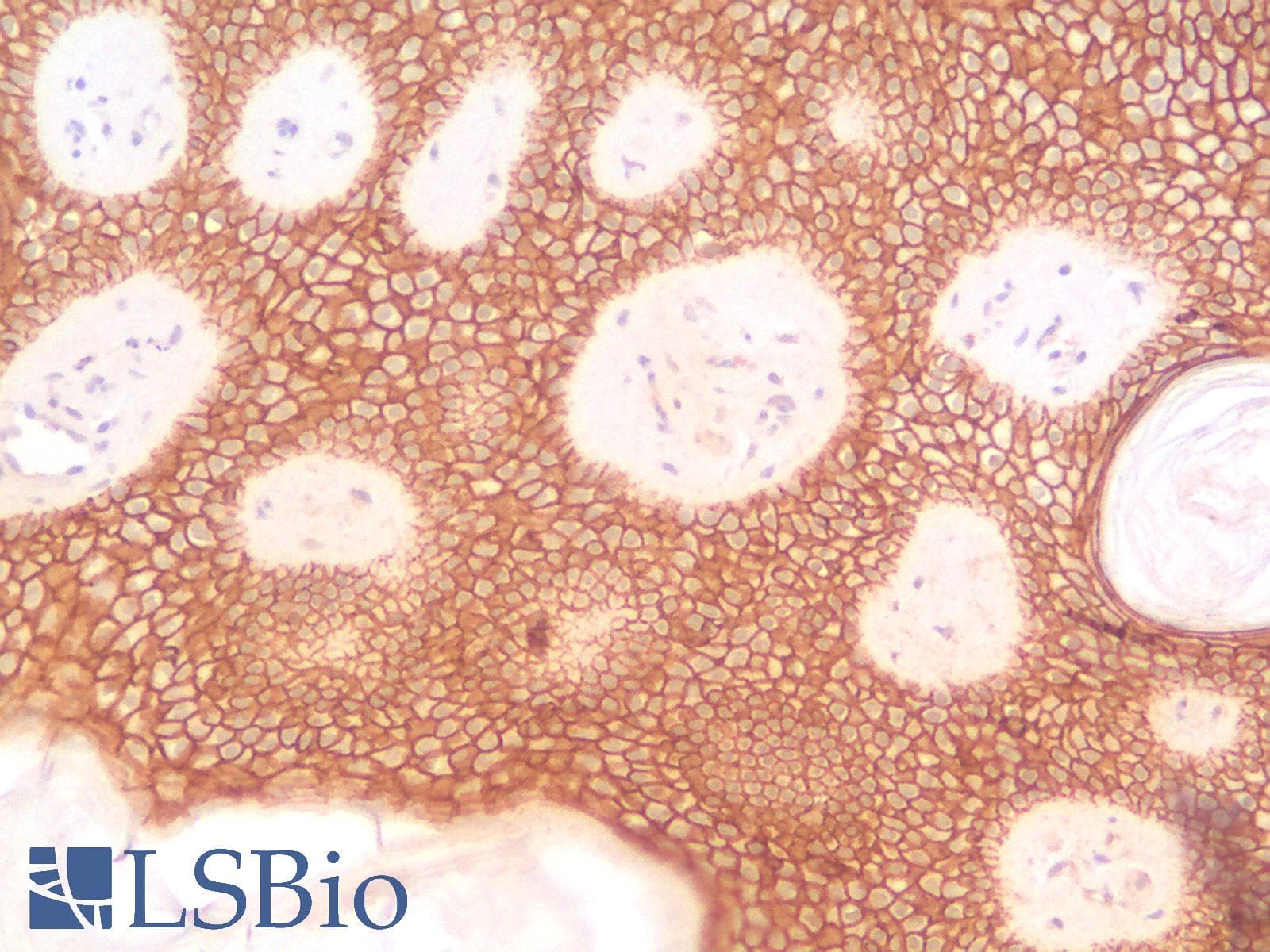 PathPlus™ Monoclonal Mouse anti-Human CDH1 / E Cadherin Antibody (Concentrated, IHC)