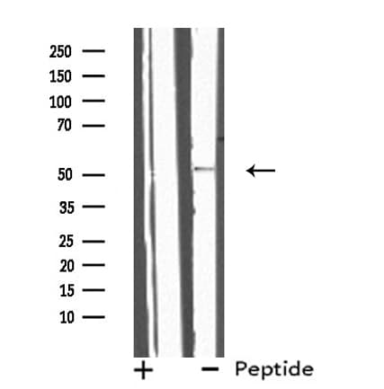IL13RA2 / IL13R Alpha 2 Antibody