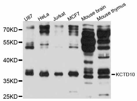Polyclonal Rabbit anti-Human KCTD10 Antibody (WB)
