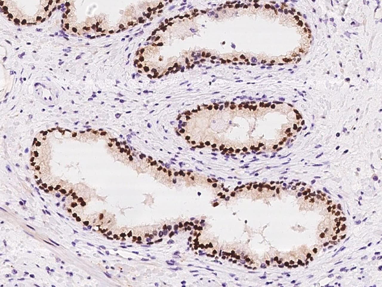 Polyclonal Rabbit anti-Human FOXA1 Antibody (IHC, IF)