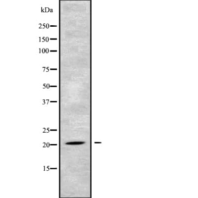 SCG10 / STMN2 Antibody